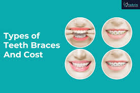 how much are braces without insurance